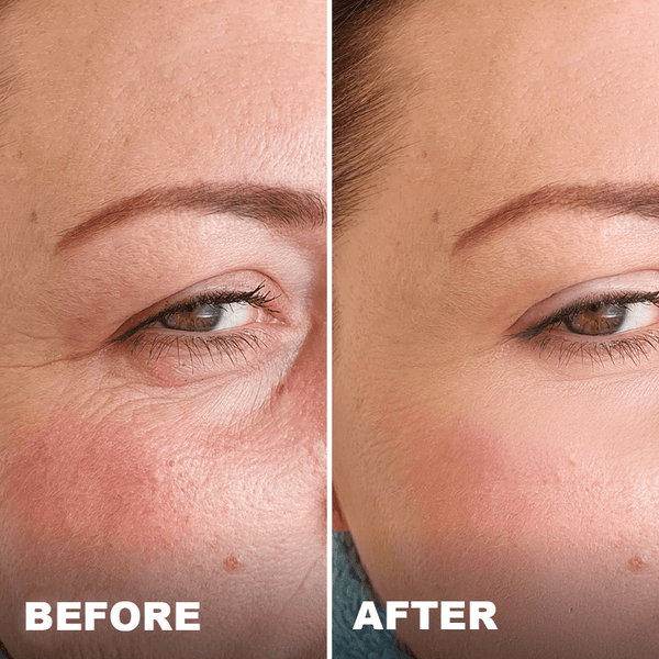 Avant / Après de Nathalie D.