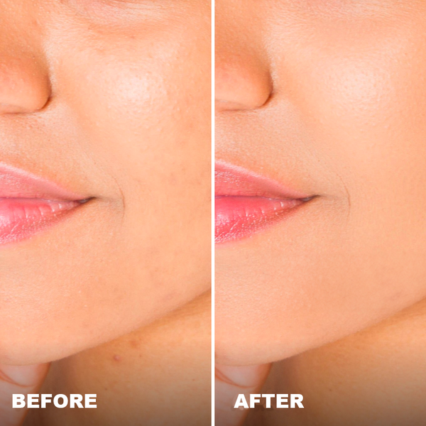 Avant / Après de Julie R.