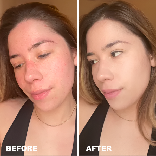 Avant / Après de Elodie H.