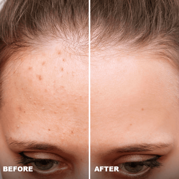 Avant / Après de Pauline C.