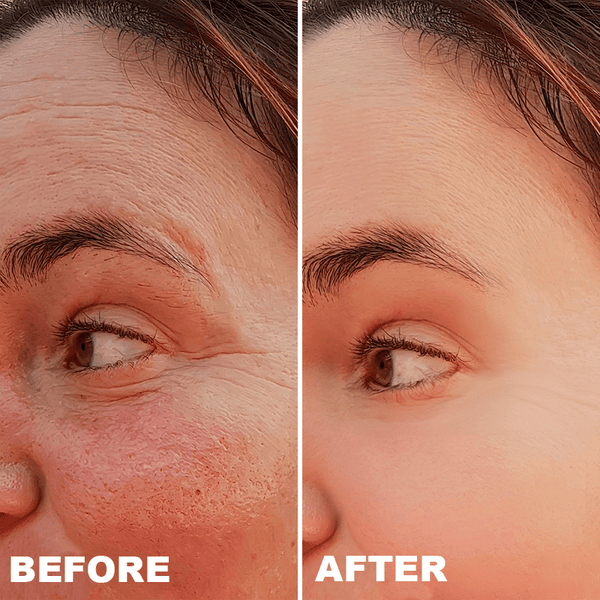 Avant / Après de Noémie R.